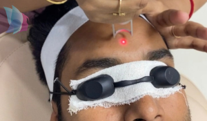 Laser Toning Treatment - Best Dermatologist in Patna